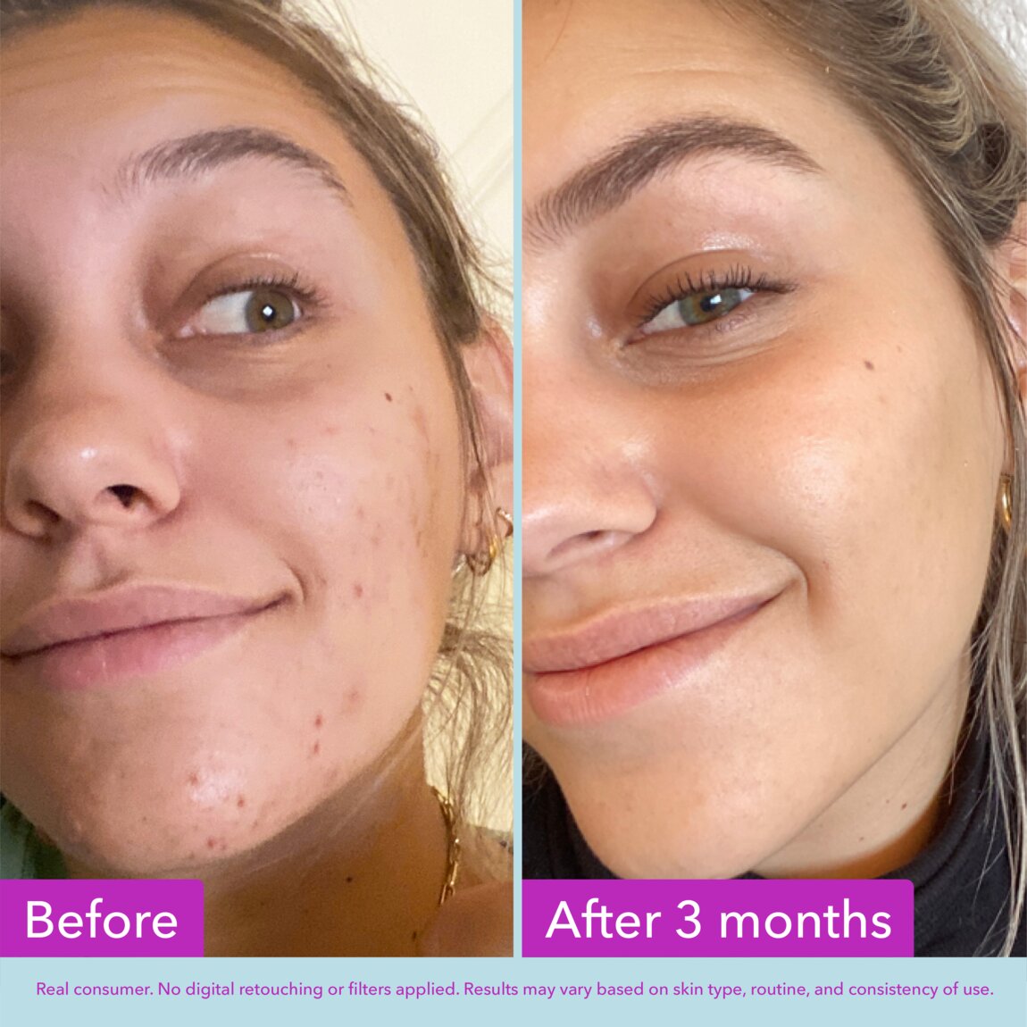 Niacinamide Brightening Toner G7
