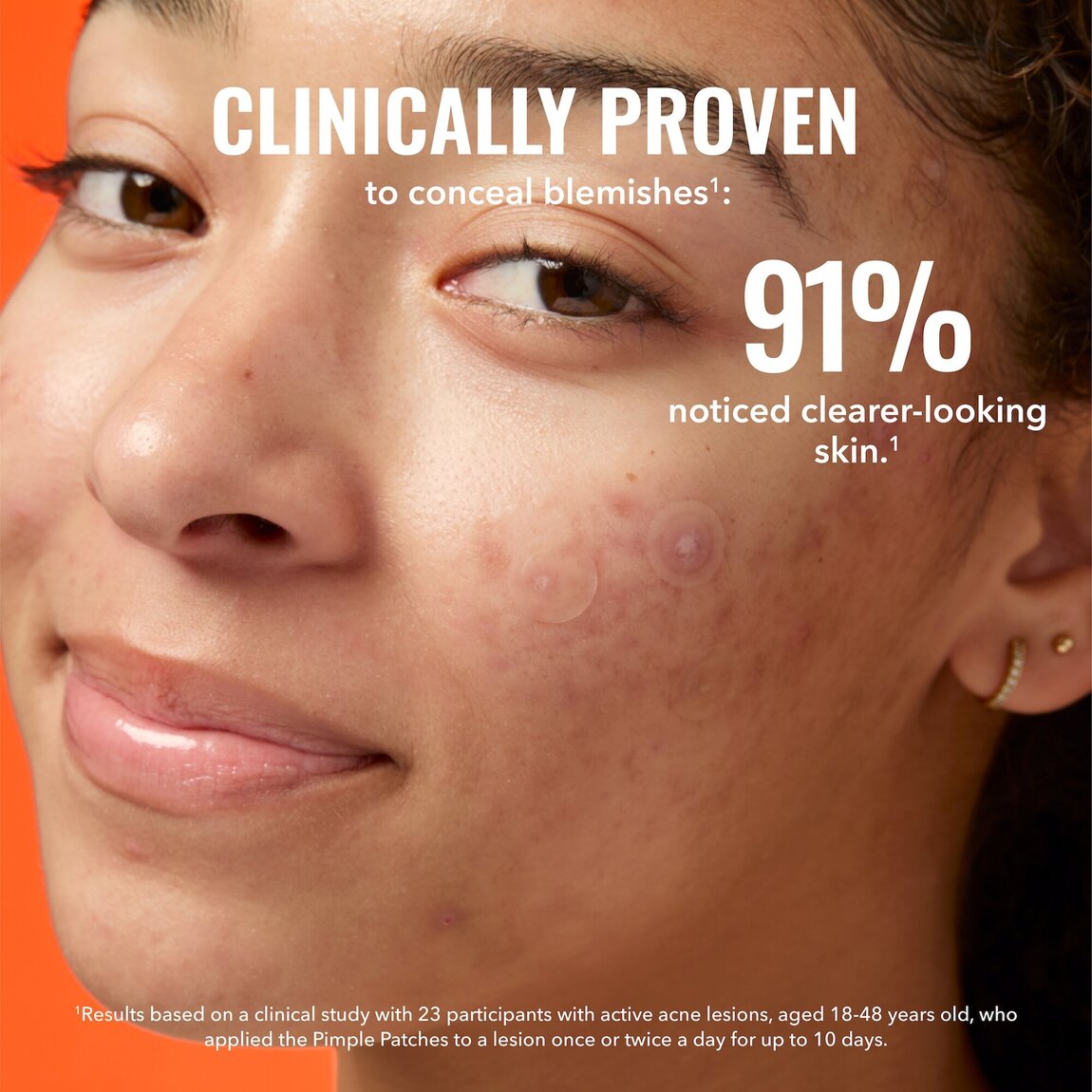 Pimple Patches D1