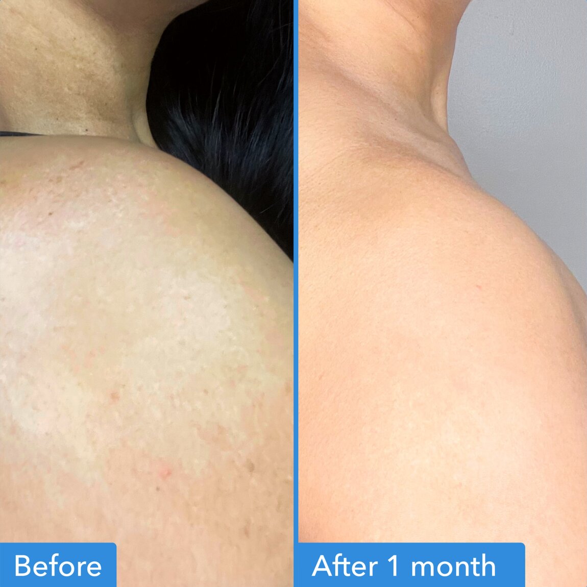 Discoloration Correcting Body Treatment I5