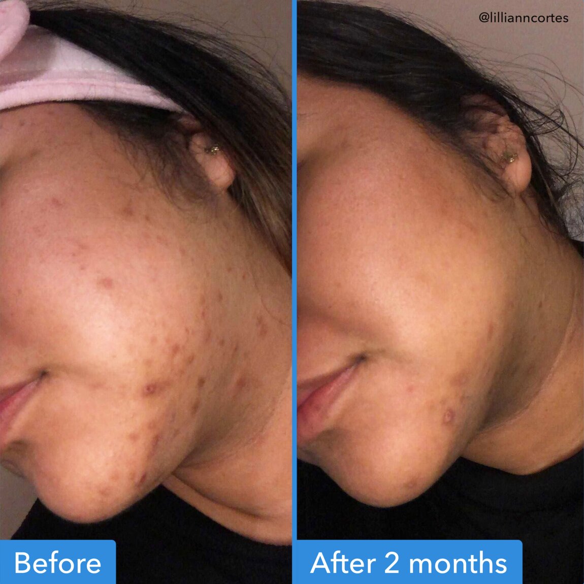 Discoloration Correcting Serum M5